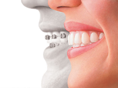 Granger Dentistry | TMJ Disorders, Sedation Dentistry and Dermal Fillers