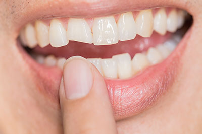 Granger Dentistry | Full Mouth Reconstruction, Orthodontics and Dental Bridges