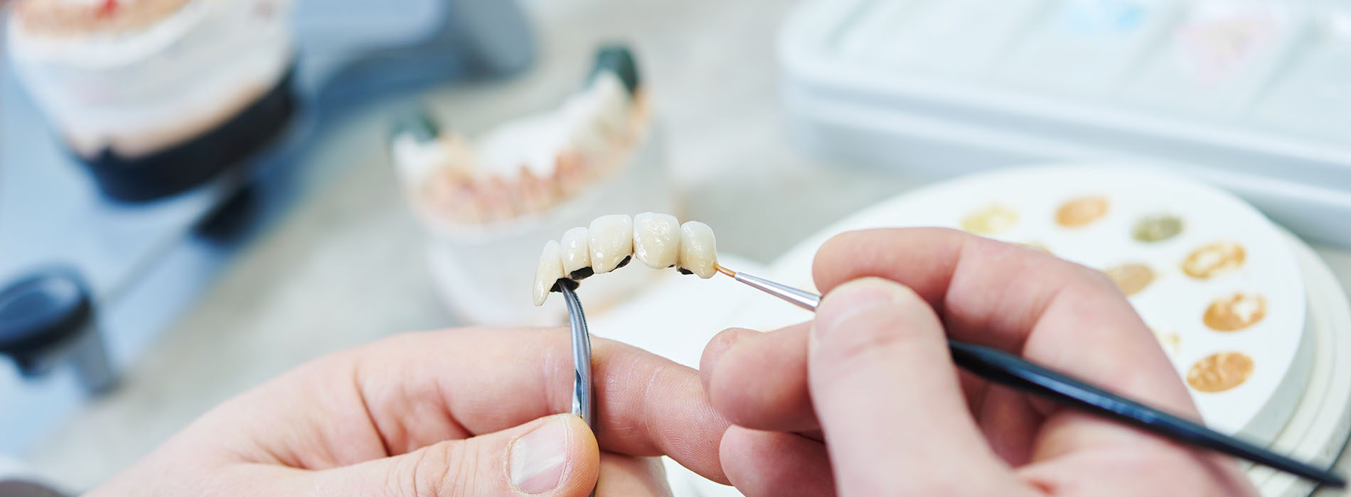 Granger Dentistry | Dental Bridges, Orthodontics and Digital Impressions