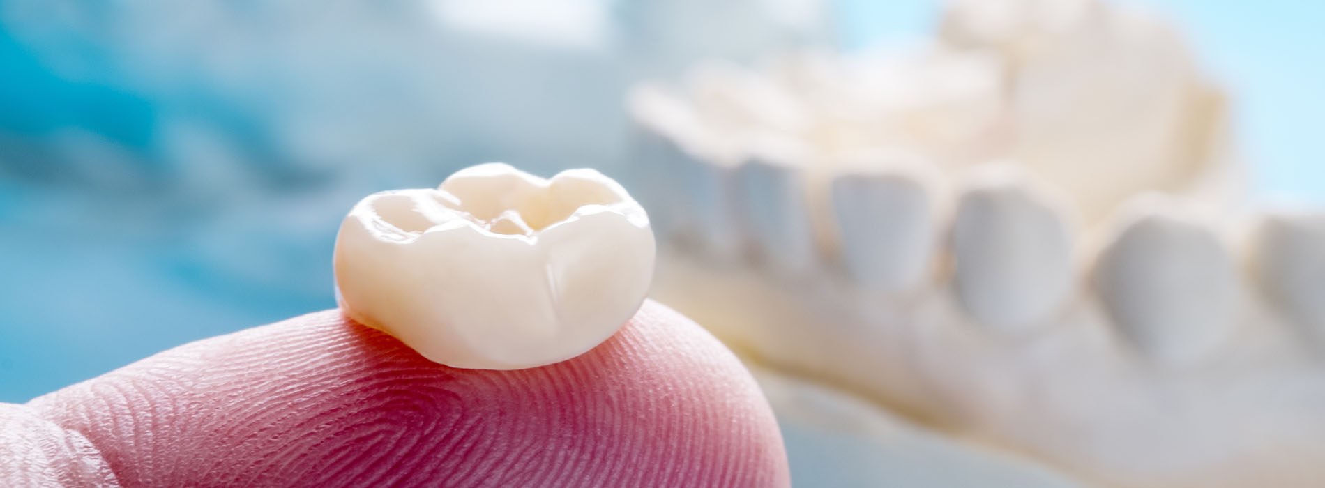 Granger Dentistry | Implant Dentistry, Cosmetic Dentistry and Extractions