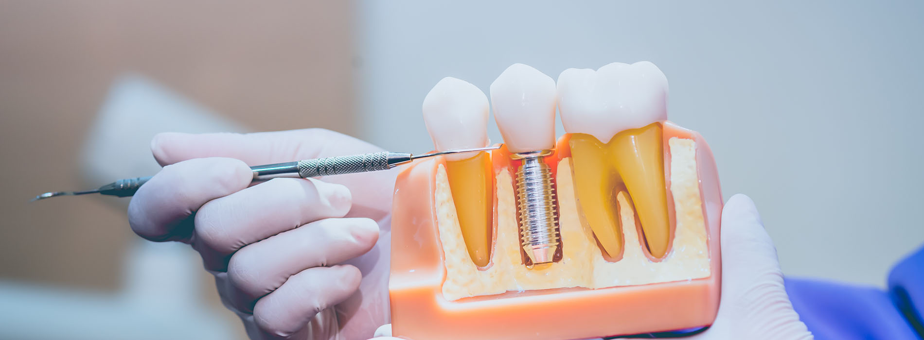 Granger Dentistry | Dental Sealants, Extractions and Dental Cleanings