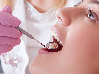 Granger Dentistry | Night Guards, Oral Exams and Full Mouth Reconstruction